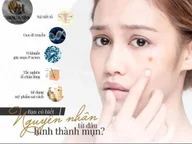 Lấy Nhân Mụn - Chou Spa 33 Phan Huy Ôn logo