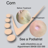 Walk IN Foot Clinic logo
